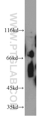 POLA2 Antibody in Western Blot (WB)