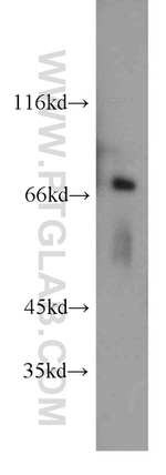 POLA2 Antibody in Western Blot (WB)