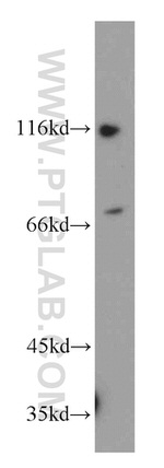 POLA2 Antibody in Western Blot (WB)