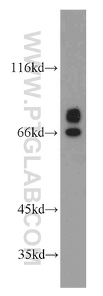 POLA2 Antibody in Western Blot (WB)