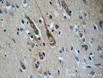 CHT1 Antibody in Immunohistochemistry (Paraffin) (IHC (P))