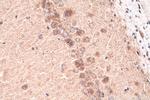 CHT1 Antibody in Immunohistochemistry (Paraffin) (IHC (P))