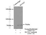 CHT1 Antibody in Immunoprecipitation (IP)