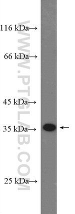 RBM7 Antibody in Western Blot (WB)