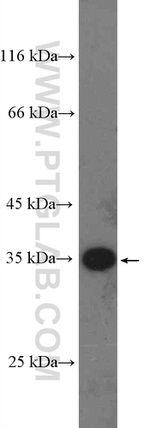 RBM7 Antibody in Western Blot (WB)