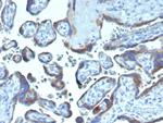 Fibroblast Activation Protein Alpha/FAP-1 Antibody in Immunohistochemistry (Paraffin) (IHC (P))