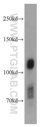 DNAJC6/AUXILIN Antibody in Western Blot (WB)