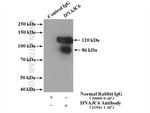 DNAJC6/AUXILIN Antibody in Immunoprecipitation (IP)