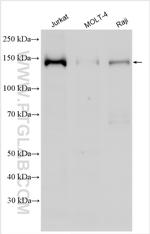 NCOA1/SRC-1 Antibody in Western Blot (WB)