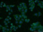 ROM1 Antibody in Immunocytochemistry (ICC/IF)