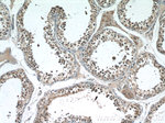 NFATC2 Antibody in Immunohistochemistry (Paraffin) (IHC (P))