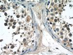 NFATC2 Antibody in Immunohistochemistry (Paraffin) (IHC (P))