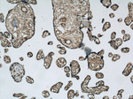 PIK3C2A Antibody in Immunohistochemistry (Paraffin) (IHC (P))