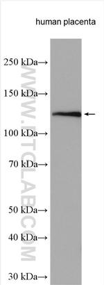 Cadherin-20 Antibody in Western Blot (WB)