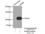 PDE6B Antibody in Immunoprecipitation (IP)