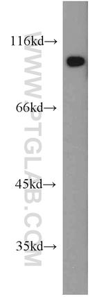 PDE6B Antibody in Western Blot (WB)