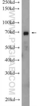 Ubiquilin 1 Antibody in Western Blot (WB)