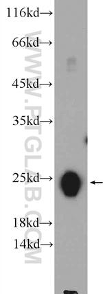 TNNI2 Antibody in Western Blot (WB)