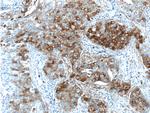 FUT4 Antibody in Immunohistochemistry (Paraffin) (IHC (P))