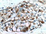 FUT4 Antibody in Immunohistochemistry (Paraffin) (IHC (P))