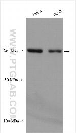 ARHGAP21 Antibody in Western Blot (WB)