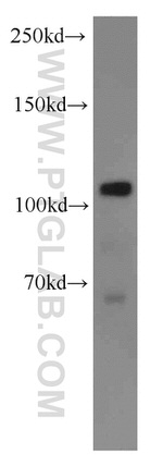Rabenosyn 5 Antibody in Western Blot (WB)