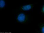 CEP164 Antibody in Immunocytochemistry (ICC/IF)