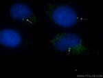 CEP164 Antibody in Immunocytochemistry (ICC/IF)