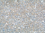 CEP164 Antibody in Immunohistochemistry (Paraffin) (IHC (P))