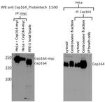 CEP164 Antibody in Immunoprecipitation (IP)