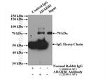ADARB1 Antibody in Immunoprecipitation (IP)
