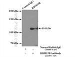 RBM15B Antibody in Immunoprecipitation (IP)