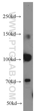 RBM15B Antibody in Western Blot (WB)