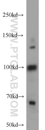 RBM15B Antibody in Western Blot (WB)