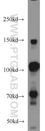 RBM15B Antibody in Western Blot (WB)