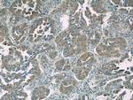 CC2D2A Antibody in Immunohistochemistry (Paraffin) (IHC (P))