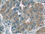 CC2D2A Antibody in Immunohistochemistry (Paraffin) (IHC (P))