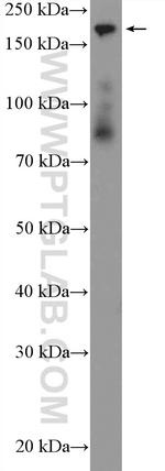 CC2D2A Antibody in Western Blot (WB)