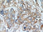 TGF-alpha Antibody in Immunohistochemistry (Paraffin) (IHC (P))