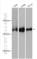 WNK4 Antibody in Western Blot (WB)