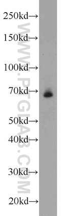 TCF4 Antibody in Western Blot (WB)