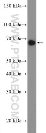 TCF4 Antibody in Western Blot (WB)