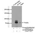 ACSL4/FACL4 Antibody in Immunoprecipitation (IP)