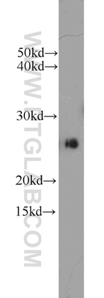 Casein Kinase 2 beta Antibody in Western Blot (WB)