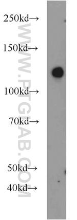 SRGAP2 Antibody in Western Blot (WB)