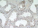 C9orf72 Antibody in Immunohistochemistry (Paraffin) (IHC (P))
