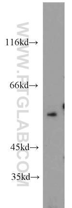 C9orf72 Antibody in Western Blot (WB)
