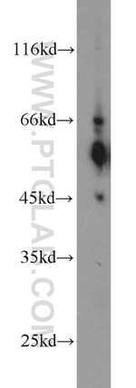 C9orf72 Antibody in Western Blot (WB)