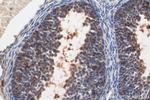 FSHR Antibody in Immunohistochemistry (Paraffin) (IHC (P))