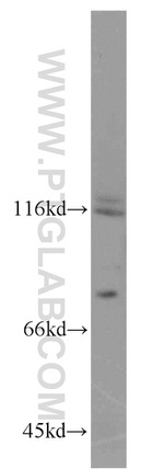 FSHR Antibody in Western Blot (WB)